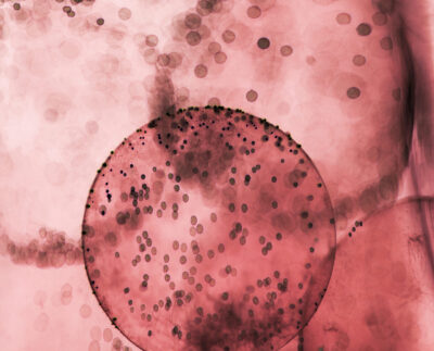 Do these common cough remedies actually work