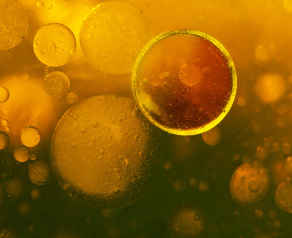 What is iodine and why do I need it